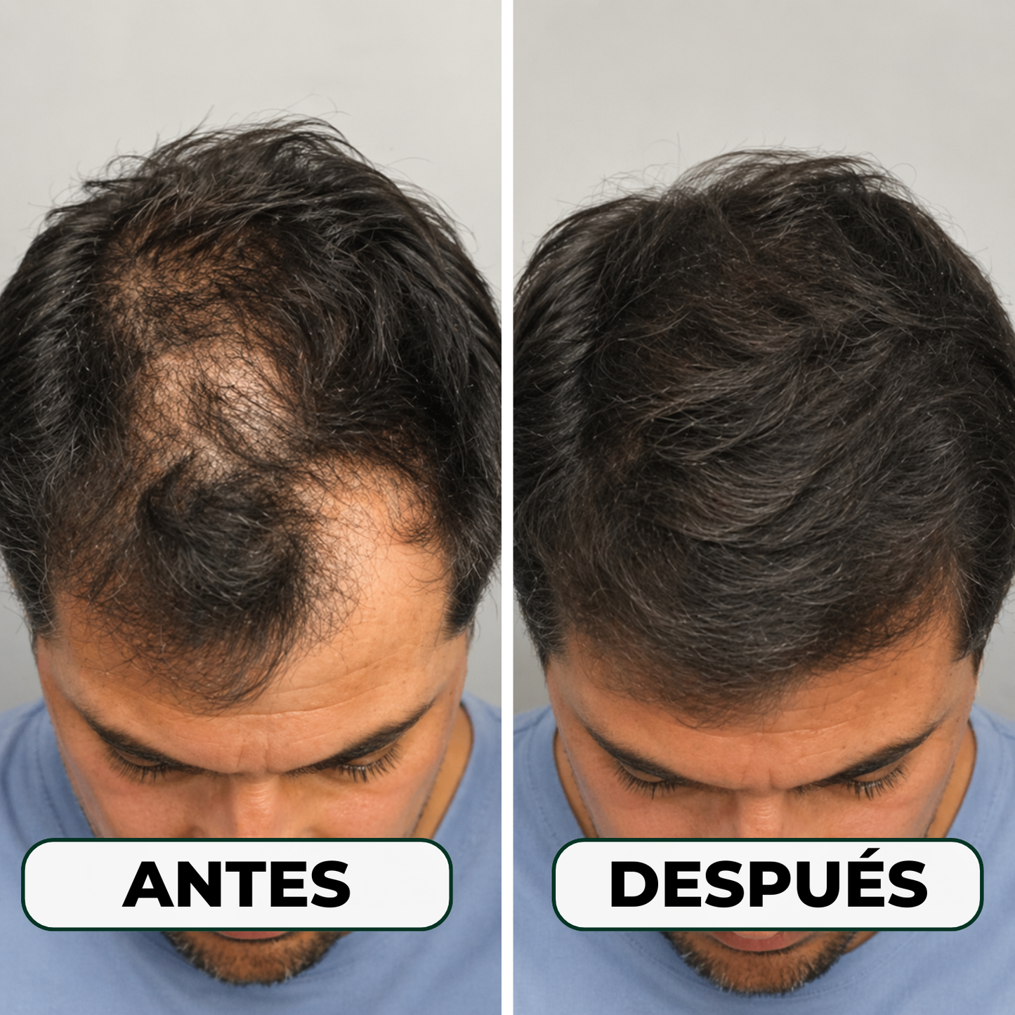 Serum Anticaída Triple Acción Skinfinity®