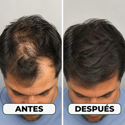 Serum Anticaída Triple Acción Skinfinity®