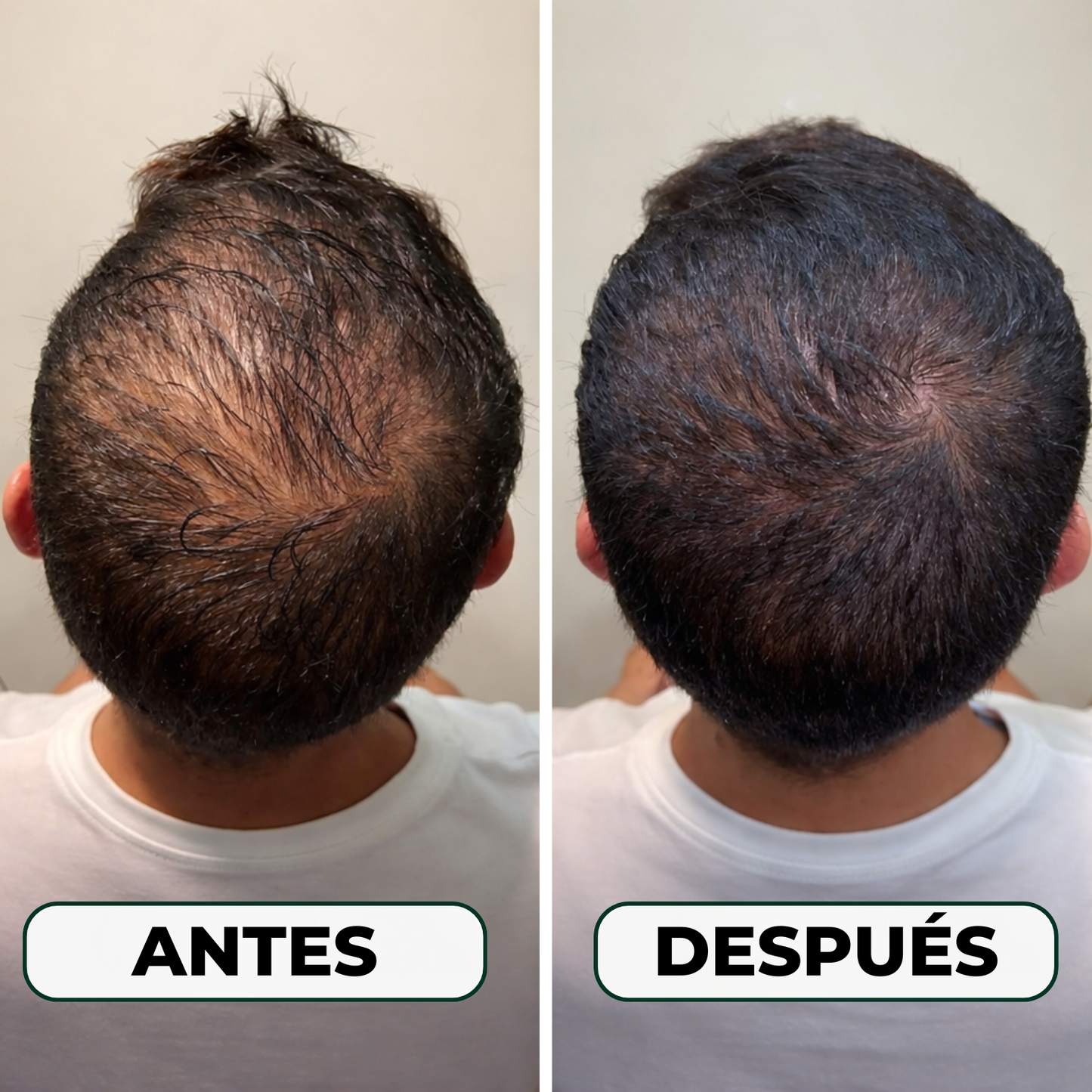 Serum Anticaída Triple Acción Skinfinity®